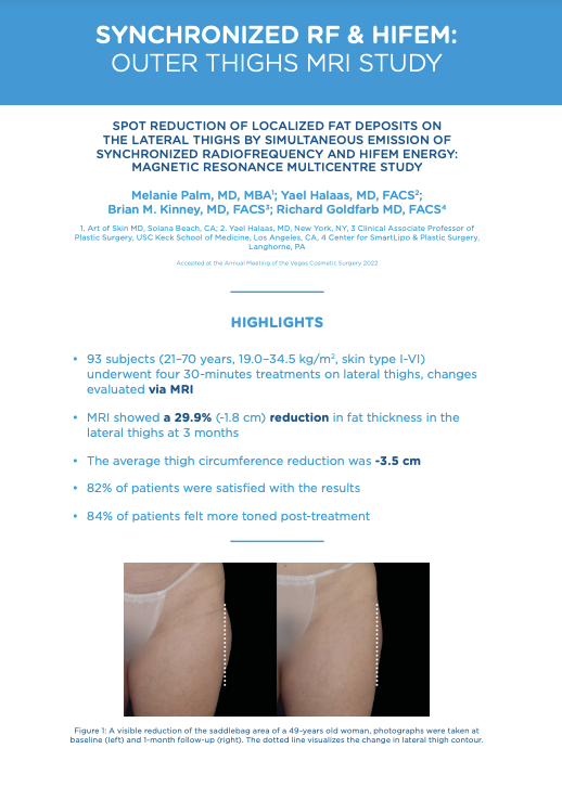 Outer thighs MRI study summary showing saddlebag reduction