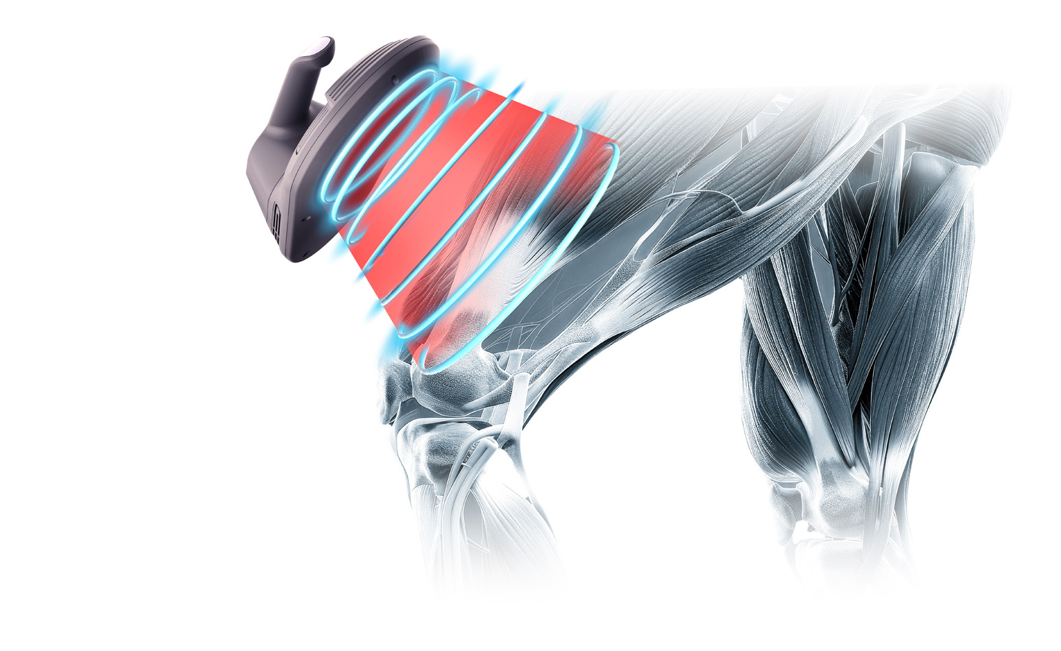 Illustration of the EMSCULPT NEO applicator delivering radiofrequency and electromagnetic energy into muscle around the knee